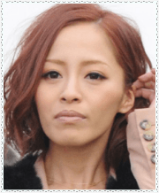 こちらの写真がメディアにとても多く出演していた頃の画像なんですが、この頃でさえ小森純さんは自身で整形を告白している